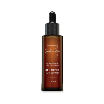 Canadian Grace 100% Organic Rosehip Oil – Cold-Pressed, Pure & Premium for Skin Rejuvenation & Hydration